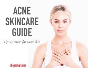 How To Prevent Acne And Skin Care Tips-shopnobari