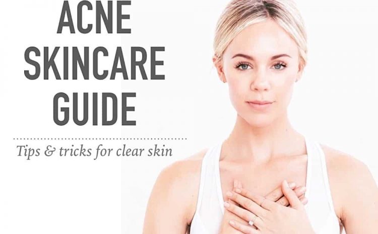 How To Prevent Acne And Skin Care Tips-shopnobari